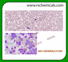 MAY-GRUNWALD STAIN