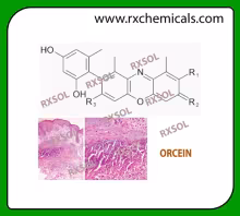 ORCEIN
